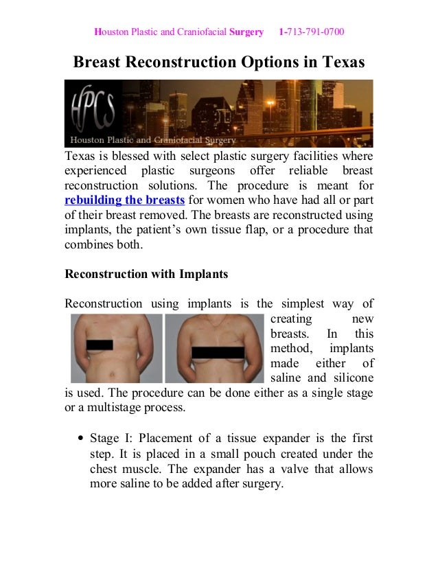 houston breast reconstruction Houston breast reconstruction